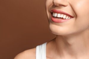 牙齒縫隙大好困擾？牙縫變大如何補救？3種補救方式不能錯過！